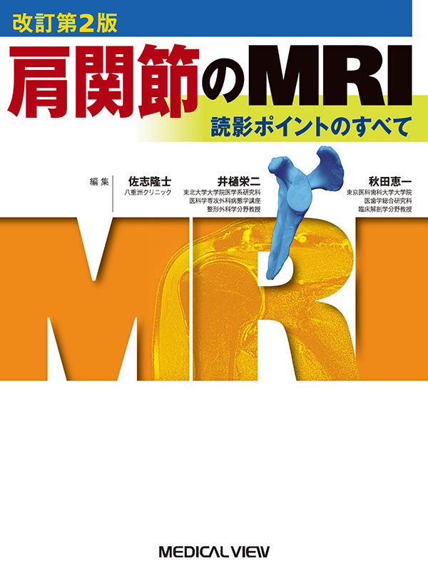 肩関節のMRI
