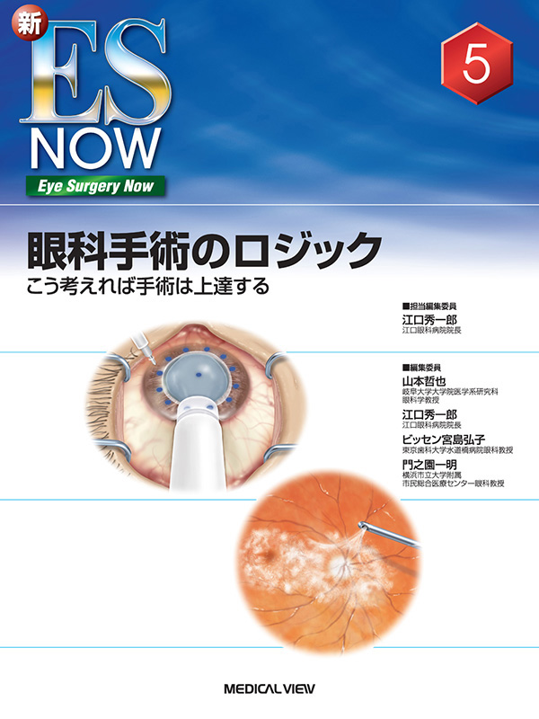 眼科手術のロジック