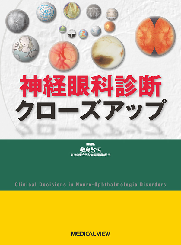 神経眼科診断クローズアップ