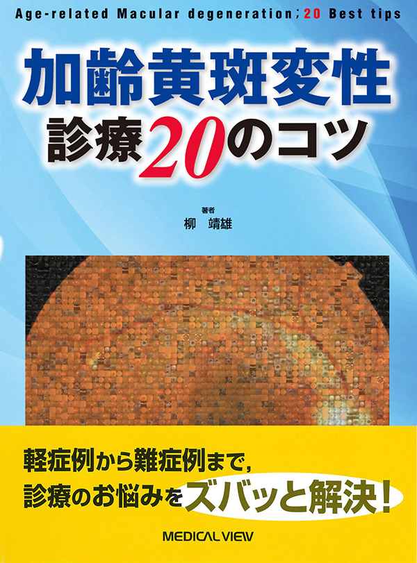 メジカルビュー社｜眼科｜加齢黄斑変性 診療20のコツ