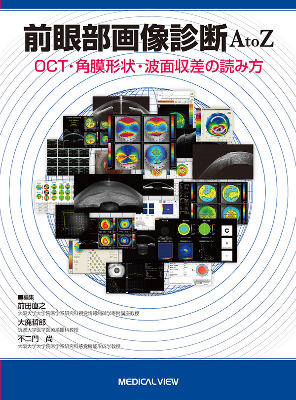 前眼部画像診断A to Z