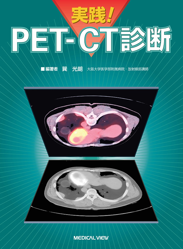 実践! PET-CT診断
