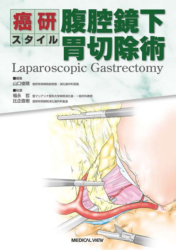 腹腔鏡下胃切除術