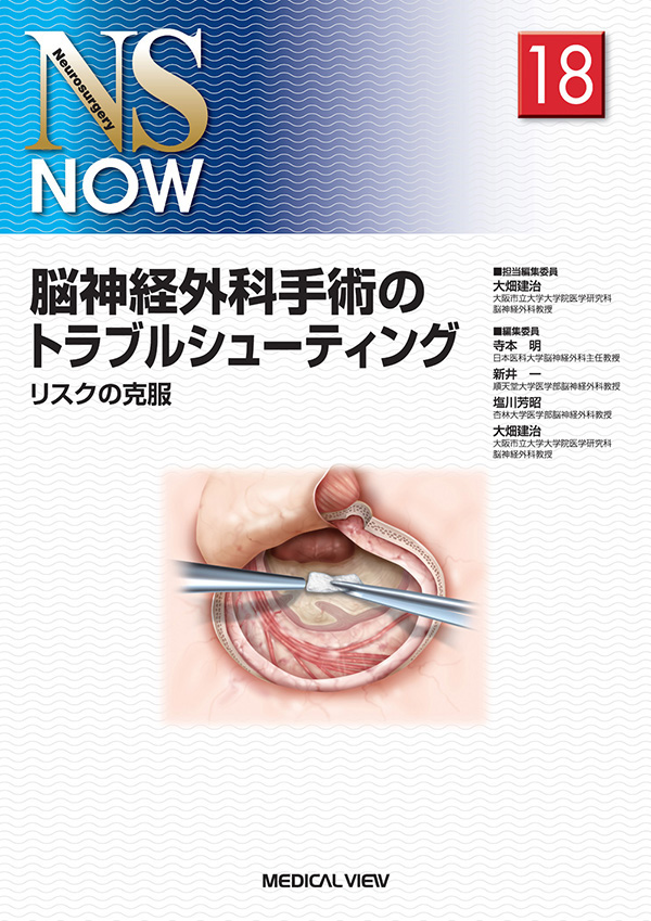 脳神経外科手術のトラブルシューティング