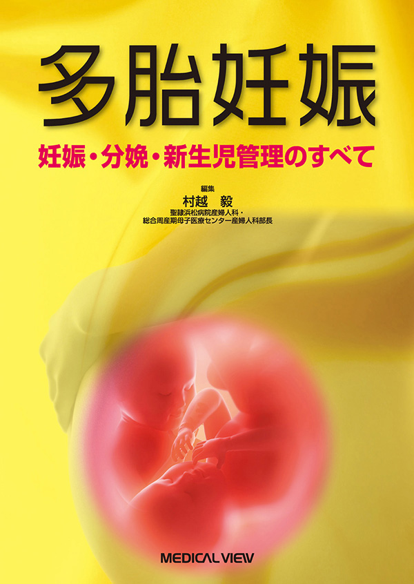 多胎妊娠