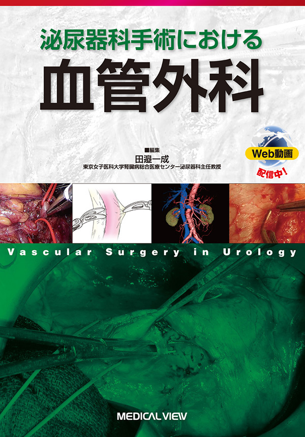 泌尿器科手術における血管外科［Web動画付］