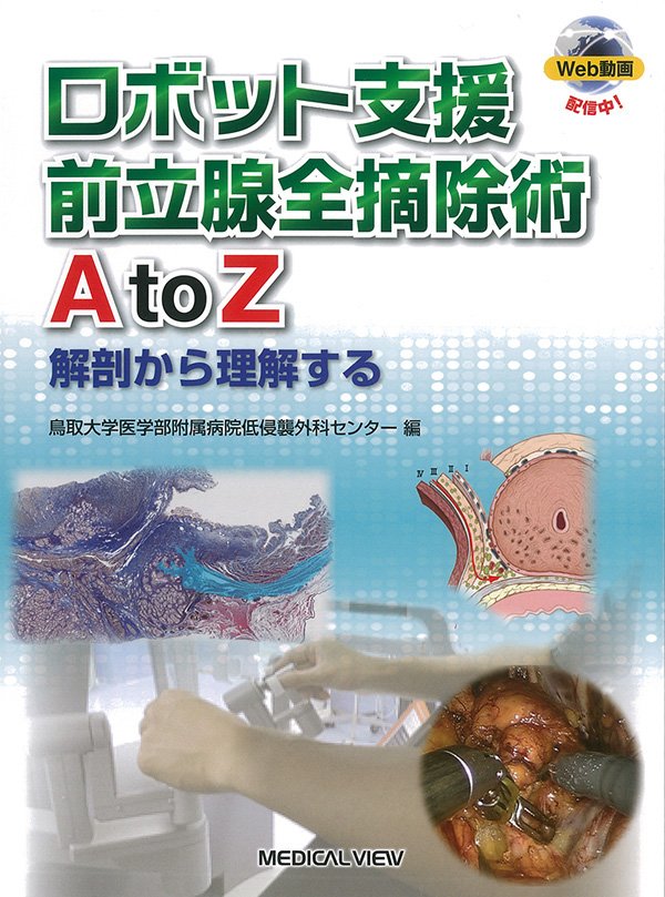 ロボット支援前立腺全摘除術 A to Z［Web動画付］