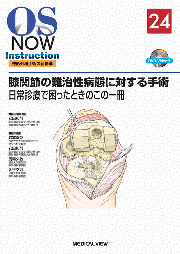 膝関節の難治性病態に対する手術