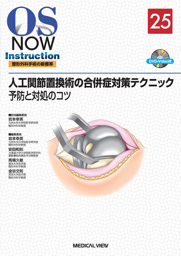人工関節置換術の合併症対策テクニック