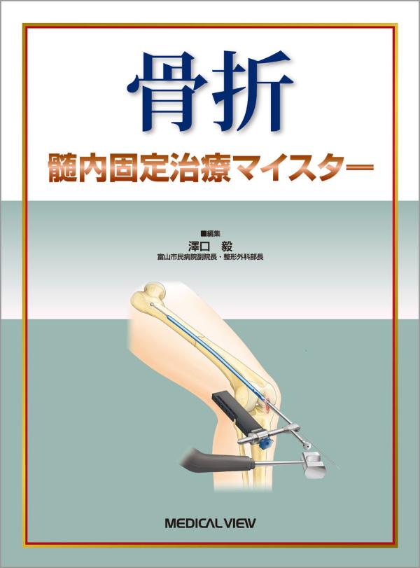 骨折　髄内固定治療マイスター