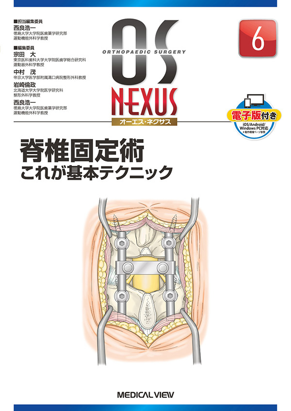 脊椎固定術　これが基本テクニック