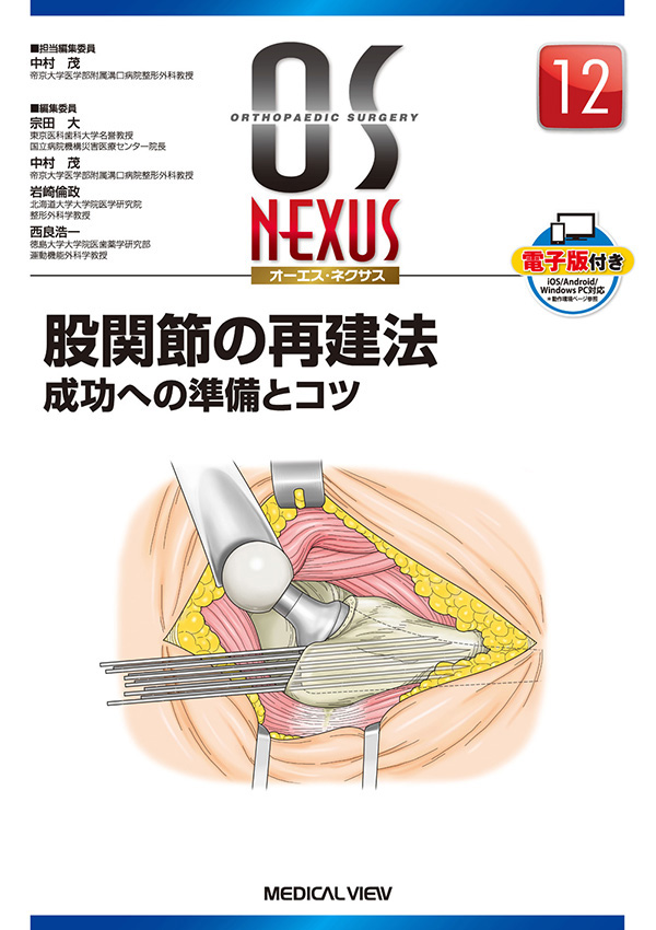 股関節の再建法