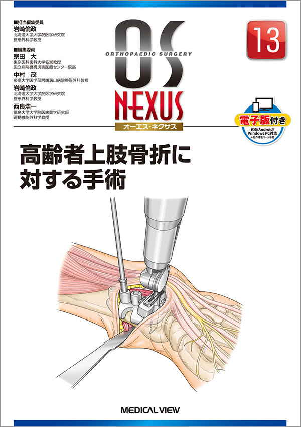 高齢者上肢骨折に対する手術