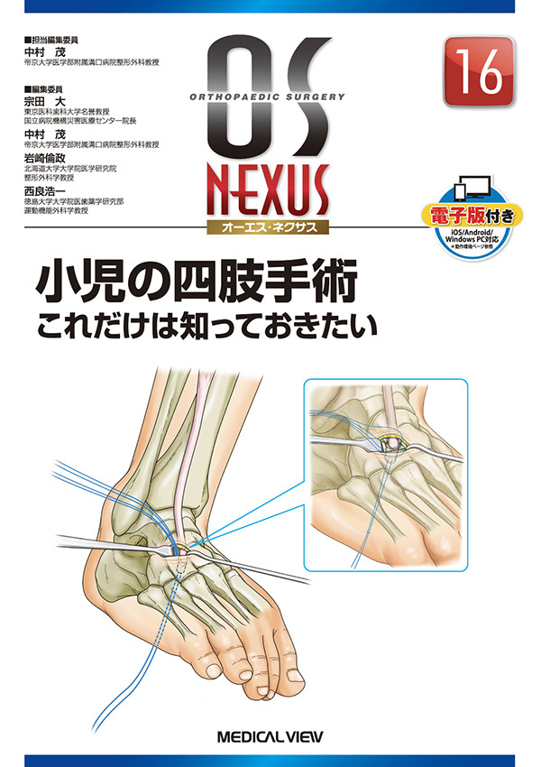 小児の四肢手術 これだけは知っておきたい