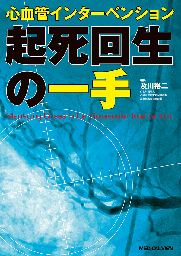 心血管インターベンション　起死回生の一手