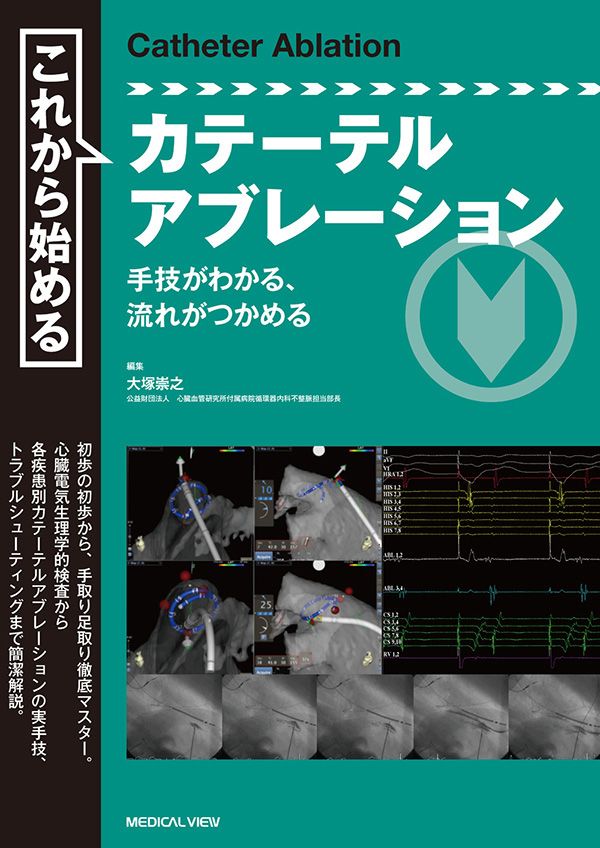 これから始めるカテーテルアブレーション