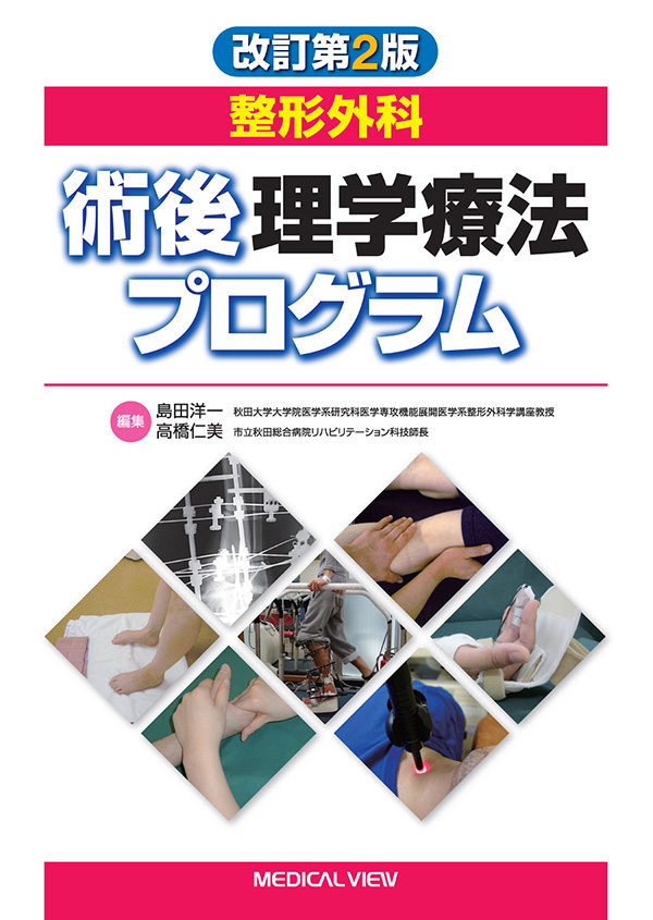 整形外科 術後理学療法プログラム