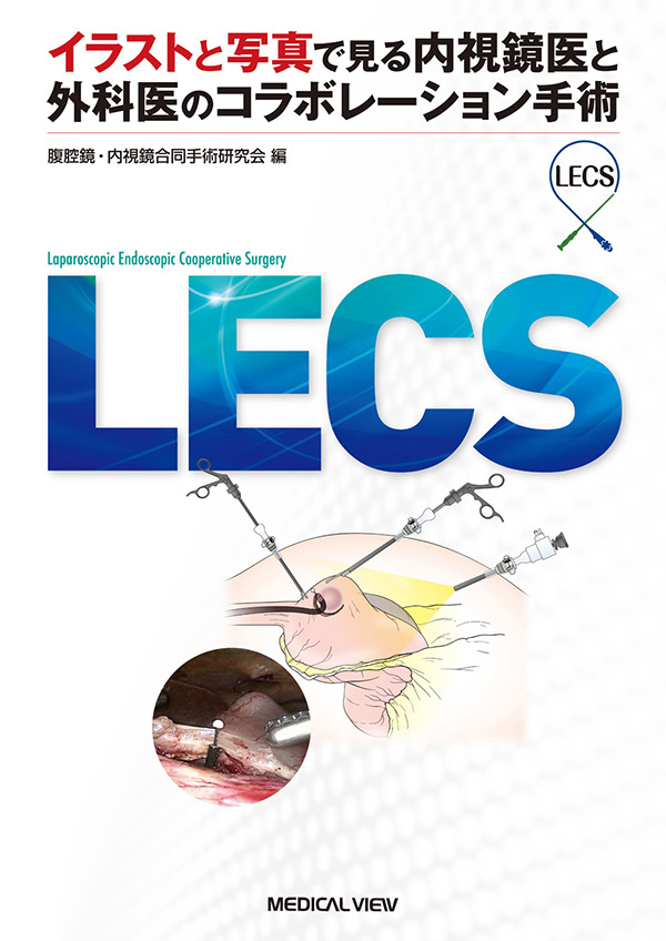 LECS