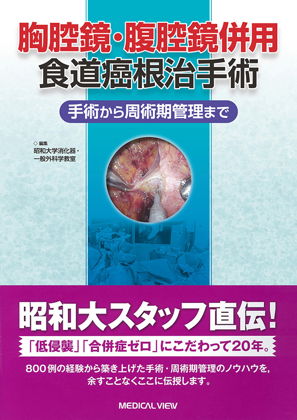 胸腔鏡・腹腔鏡併用食道癌根治手術