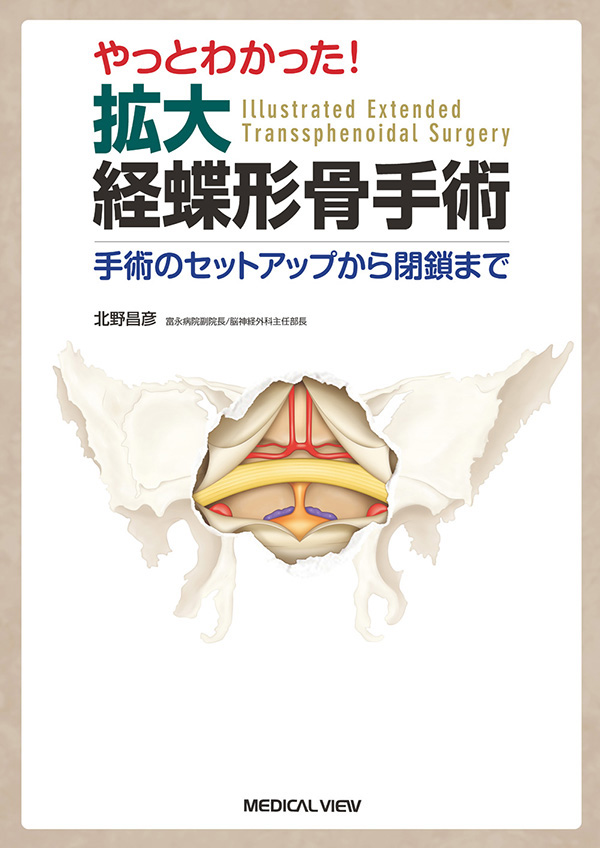 メジカルビュー社 脳神経外科 拡大経蝶形骨手術