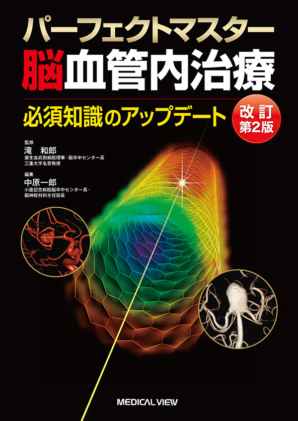 パーフェクトマスター脳血管内治療