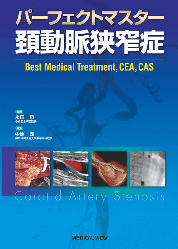 パーフェクトマスター　頚動脈狭窄症