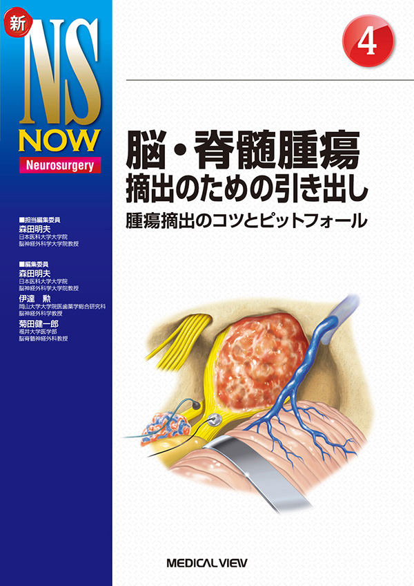 脳・脊髄腫瘍摘出のための引き出し