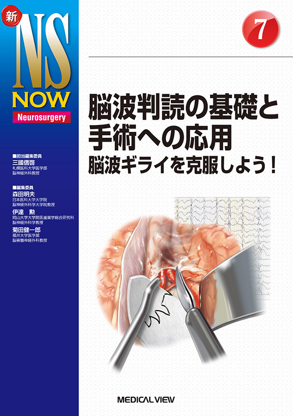 脳波判読の基礎と手術への応用