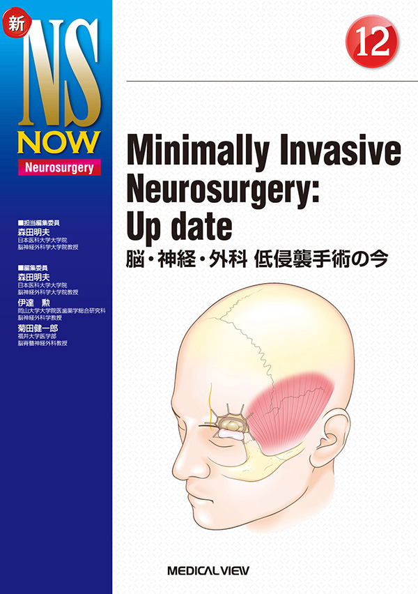 Minimally Invasive Neurosurgery : Up date