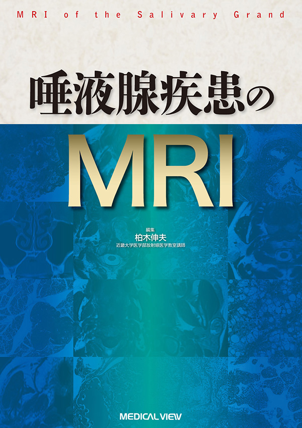 唾液腺疾患のMRI