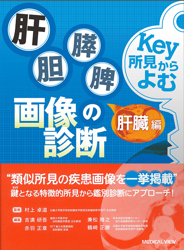 Key所見からよむ肝胆膵脾の画像診断　肝臓編