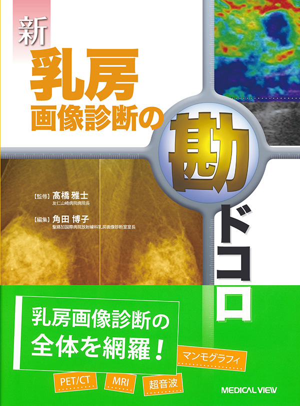 新　乳房画像診断の勘ドコロ