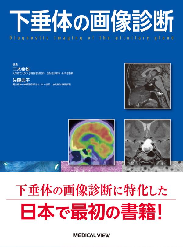 下垂体の画像診断