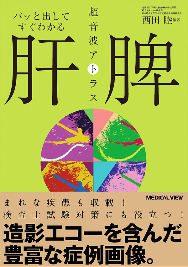 肝・脾　超音波アトラス