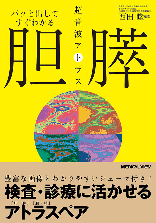 胆・膵　超音波アトラス