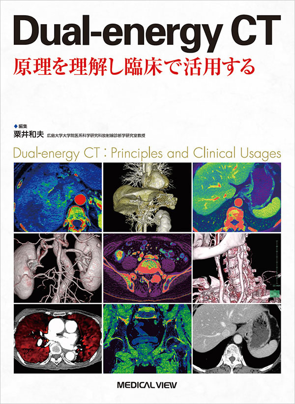 Dual-energy CT