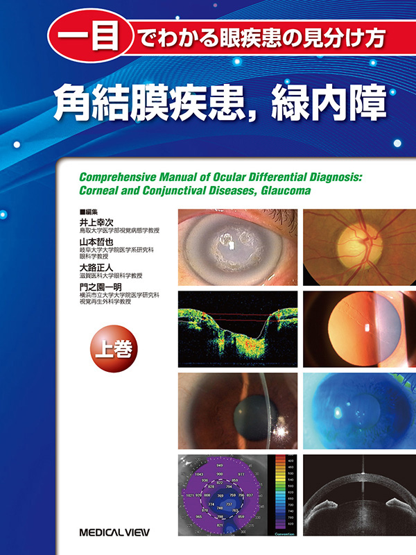 一目でわかる眼疾患の見分け方 上巻