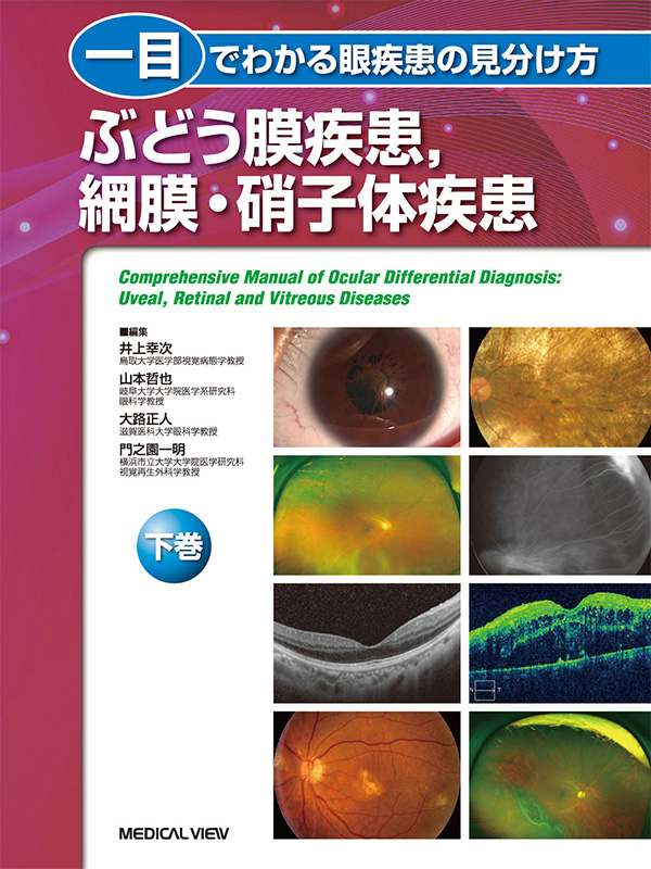 一目でわかる眼疾患の見分け方 下巻