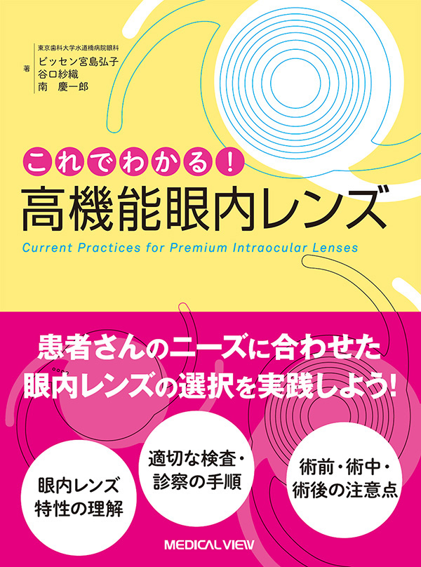 これでわかる!　高機能眼内レンズ