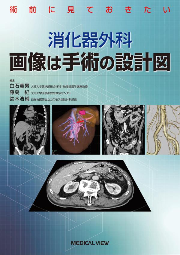 消化器外科　画像は手術の設計図