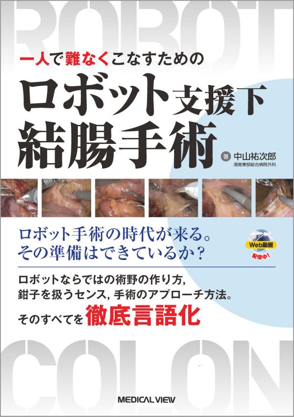 ロボット支援下結腸手術［Web動画付］