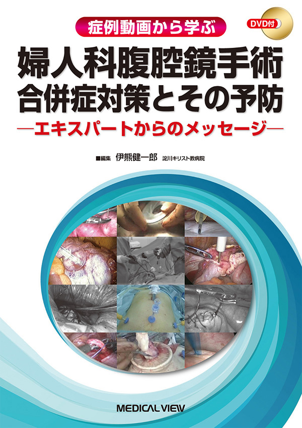 婦人科腹腔鏡手術 合併症対策とその予防