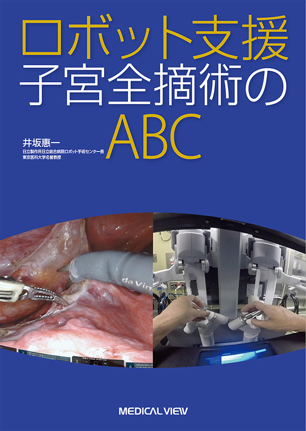 ロボット支援子宮全摘術のABC［Web動画付］