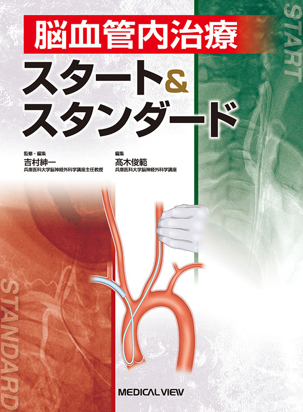 病態・治療法の本質的理解と臨床・研究発展のために/滝和郎/宮地茂/•松丸祐司　通販　PayPayモー•ル店　bookfan　完全版　フレンチホワイトの-脳血管内治療学　PayPayモール