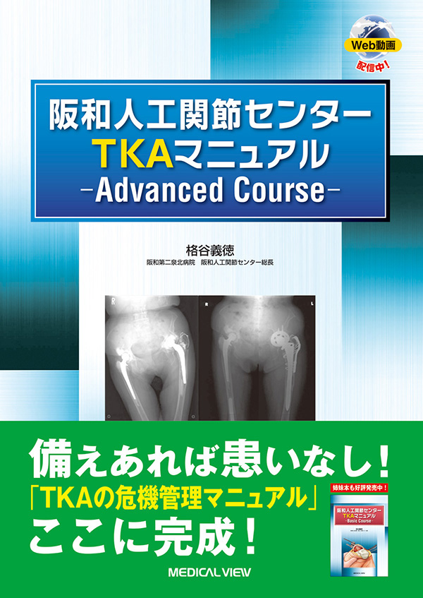 阪和人工関節センター TKAマニュアル—Advanced Course—［Web動画付］