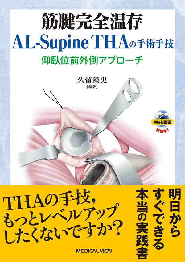 筋腱完全温存AL-Supine THAの手術手技