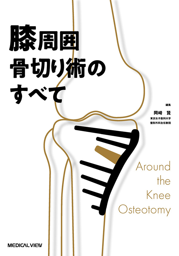 膝周囲骨切り術のすべて