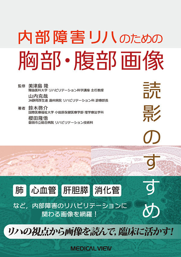 胸部・腹部画像　読影のすすめ