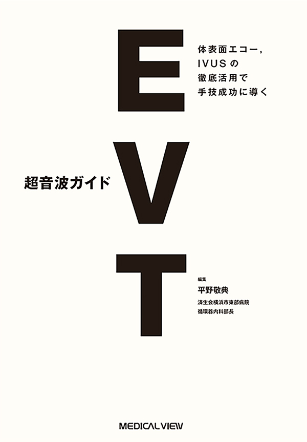 超音波ガイドEVT