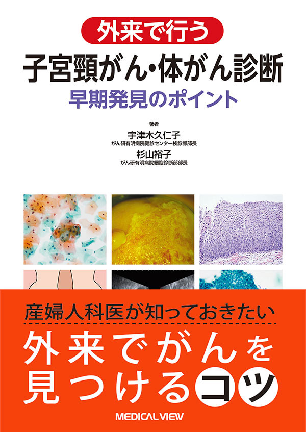 外来で行う　子宮頸がん・体がん診断